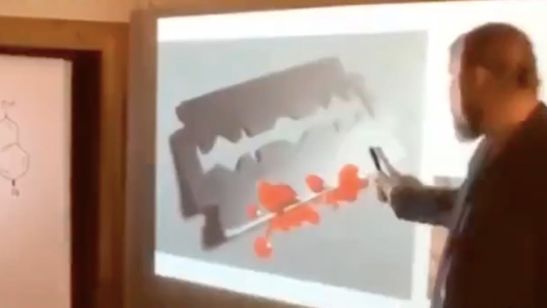 2. Dr. Noack points to an image of a razor blade on the video screen.