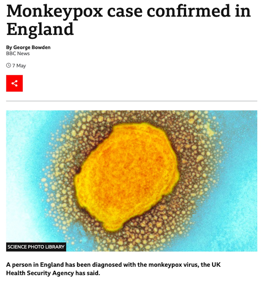Monkeypox case confirmed in England (BBC 07.05.22)